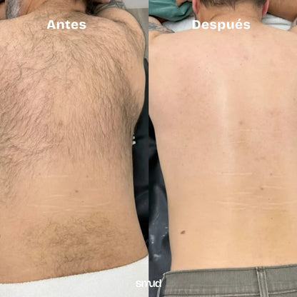 TERSA · La Piedra negro en uso