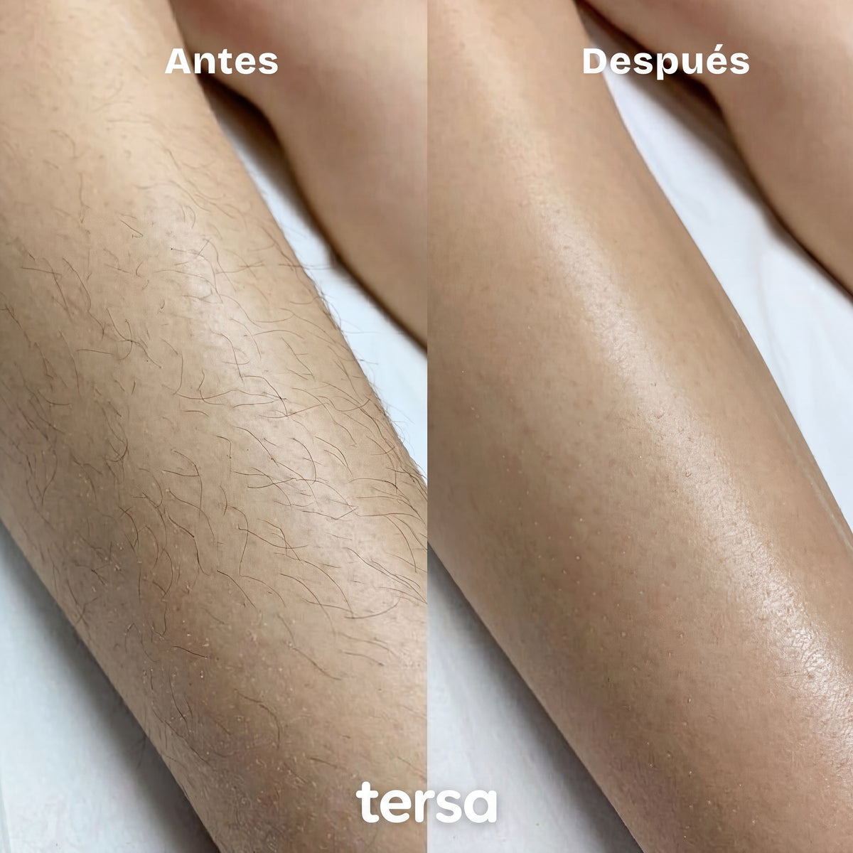 TERSA · La Piedra en uso